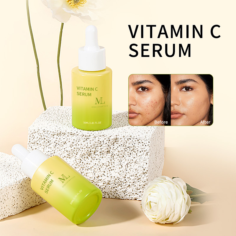 30ml Whitening Vitamin C Serum